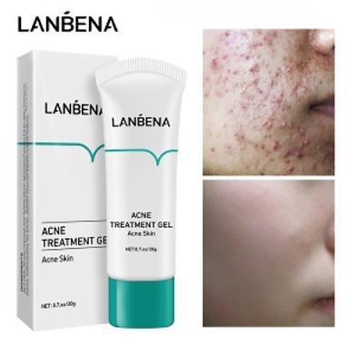 LANBENA ACNE TREATMENT GEL 20G - Image 2