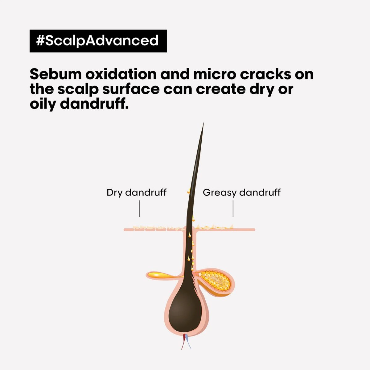 LOREAL SCALP ADVANCED ARGILE 250ML - Image 6