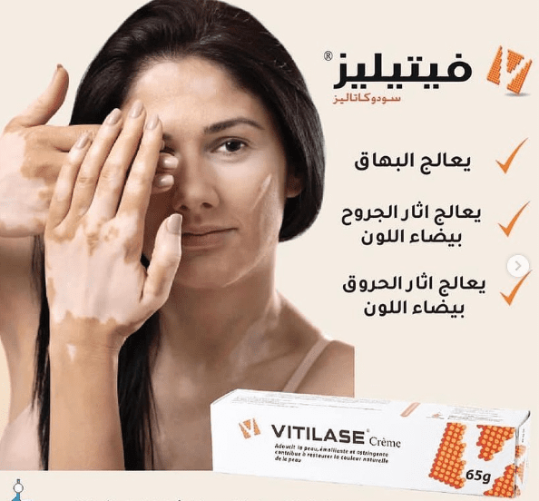VITILASE CREAM 65G - Image 2